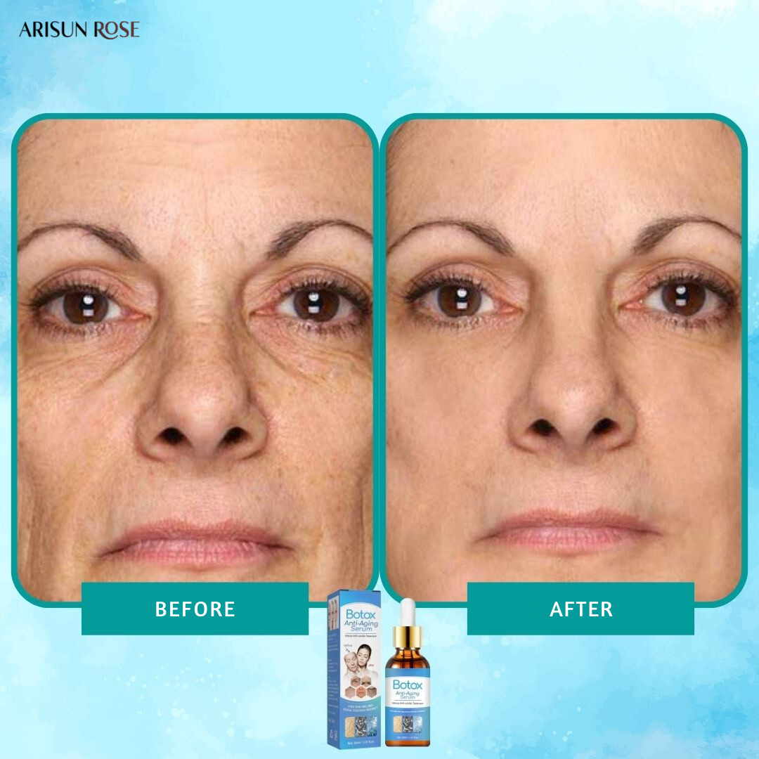 1+1 FREE | EternaLift™ | Botox Anti-aging Serum